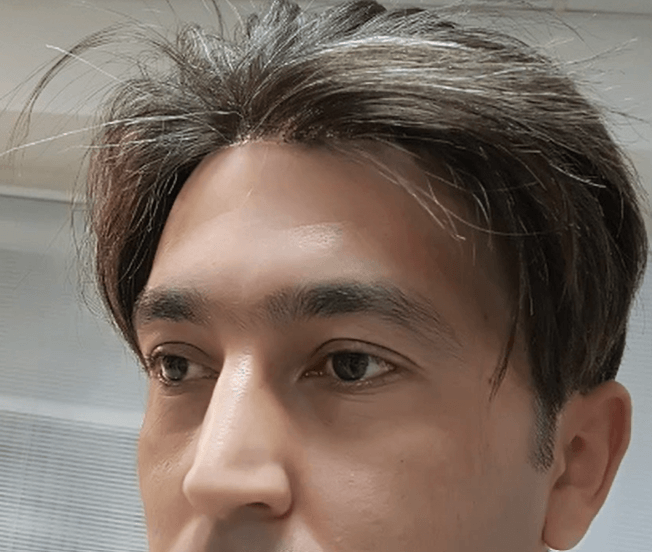 اکستنشن موی مردان